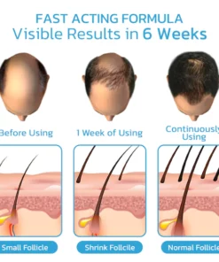 Hairmuch Hair Regrowth Ampoule Serum