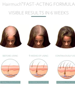 Hairmuch™ Hair Growth Ampoule Serum Lotion