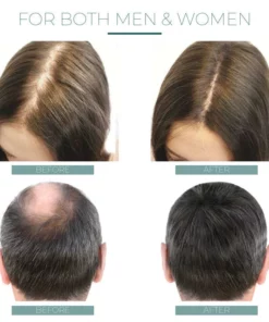 Hairmuch™ Hair Growth Ampoule Serum Lotion