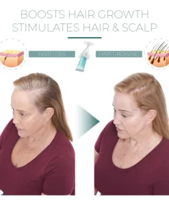 Hairmuch™ Hair Growth Ampoule Serum Lotion