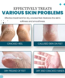 HeelHaven™ Severe Cracked Heel Balm