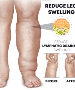 IONFit HeatingDetoxify Floral Socks