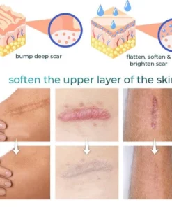 Joint & Muscle & Scar Therapy Tape