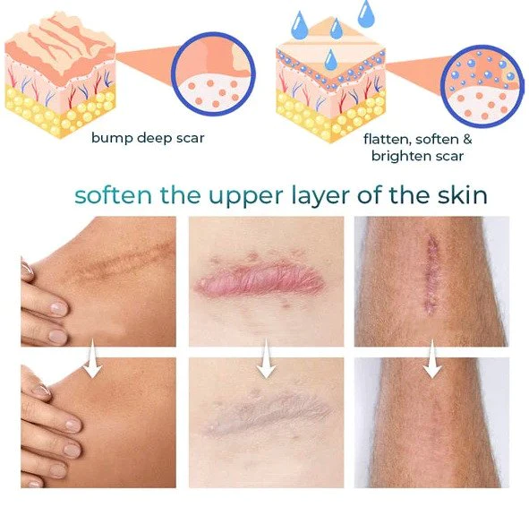 Joint & Muscle & Scar Therapy Tape