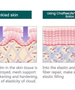 LA LIFT Revitalizing Botox Serum