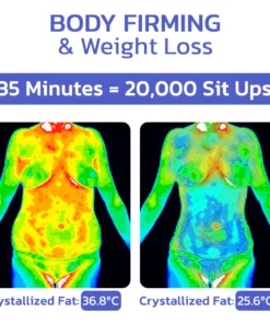 LPGTech Cryolipolysis Cooler Spray