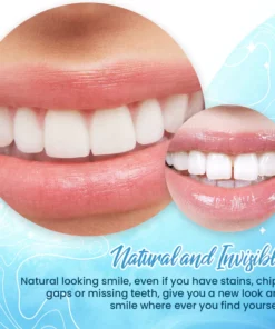 MEHARRY™ Professional Tooth Repair Shaping Teether Kit