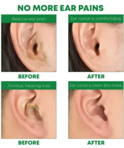 MedHealth Tinnitus EarWax Removal Kit