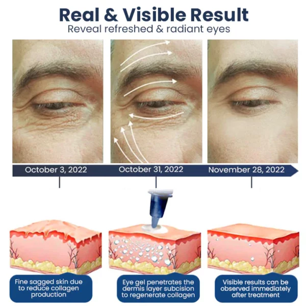 Mormuem™ PEULINSEU Gel para ojos desinflamante con péptidos Korean Awaken