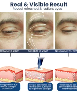 Mormuem™ PEULINSEU Korean Awaken Peptide Depuffing Eye Gel