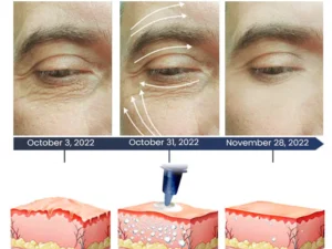 Mormuem™ PEULINSEU Korean Awaken Peptide Depuffing Eye Gel