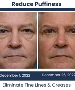 Mormuem™ PEULINSEU Korean Awaken Peptide Depuffing Eye Gel