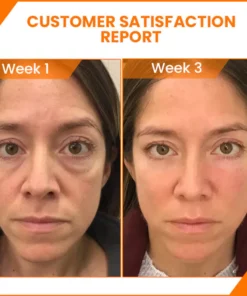 Mormuem™ PureCare Vitamin C Brightening Eye Serum