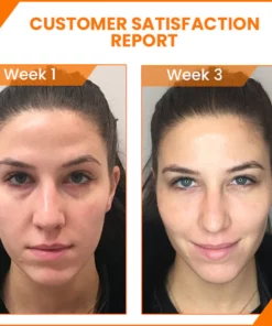 Mormuem™ PureCare Vitamin C Brightening Eye Serum