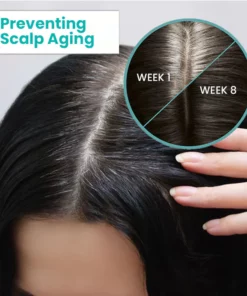 Mormuem™ ScalpReboost NMN Hair Growth Roller