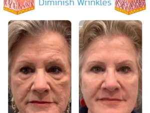 MsTimeless Collagen Firming Mask