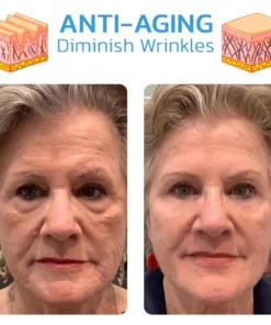 MsTimeless NMN Collagen Firming Gel