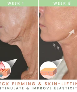 MyOeganix Lines Gone Neck-Gel