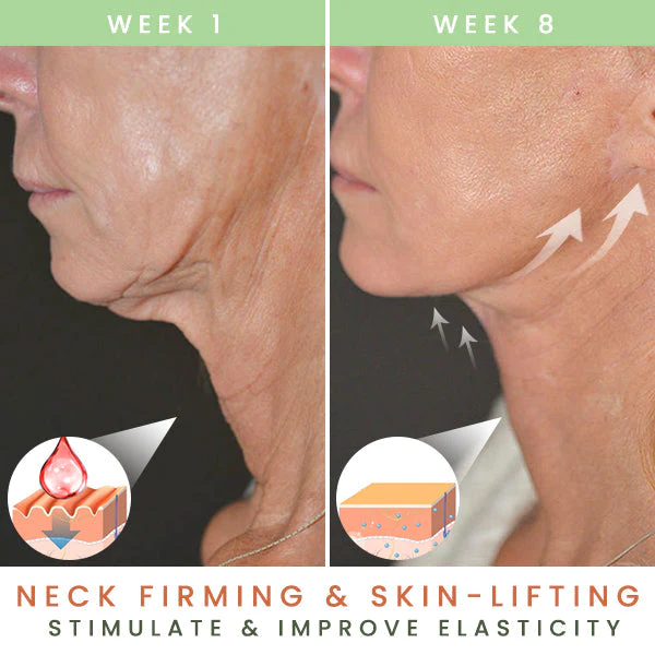 Gel MyOeganix Radiant Lines Gone Neck