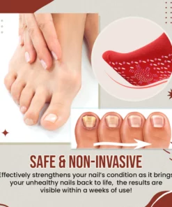 Nail Anti-Fungus Socks