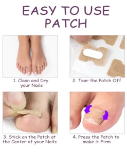 NailHeal AntiParonychia Relief Patch