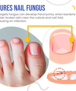 NailSpeed™ Light Cure Fungal Nail Pen