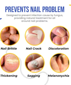 NailSpeed™ Light Cure Fungal Nail Pen