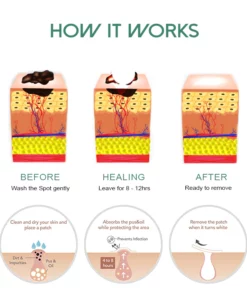 OrganicPro SkinTag FastRemover Patches