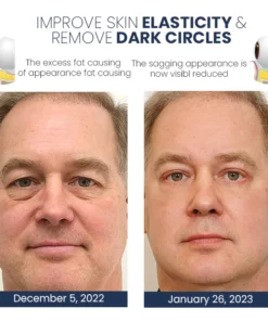 PEULINSEU Korean Awaken Peptide Depuffing Eye Gel