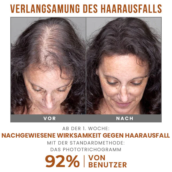 PURA Essenz Haar Wiedergeboren 生物素洗发水