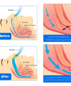 Peaceful Night Herbal SnoringSolution NasalSpray