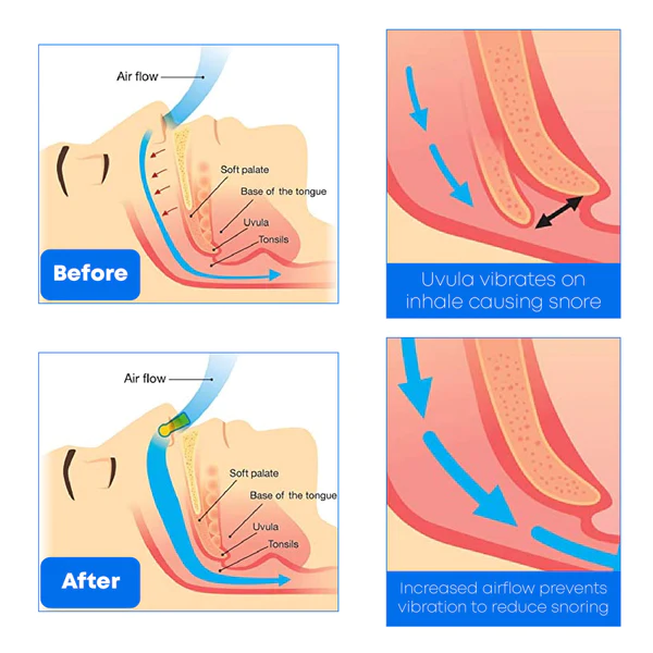 Peaceful Night Herbal SnoringSolution NasalSpray