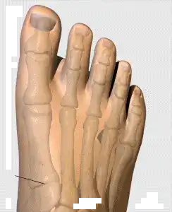 Penetrax™ Joint & Bone Therapy Cream