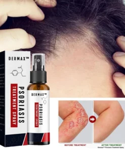 Psoriatrax Psoriasis Relief Spray