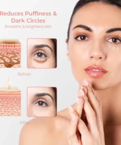 RejuvenEyes™ Peptide Lifting Eye Gel