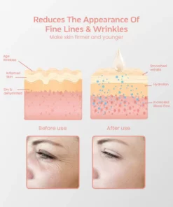 RejuvenEyes™ Peptide Lifting Eye Gel