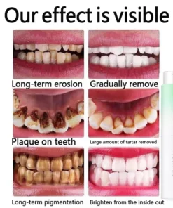 Resmile™ Pure Herbal Mouth Spray