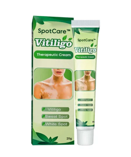 SpotCare™ Vitiligo Therapeutic Cream