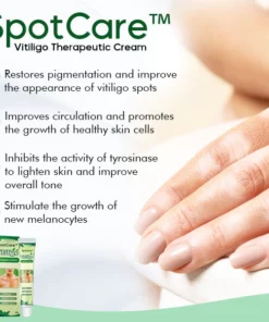 SpotCare™ Vitiligo Therapeutic Cream