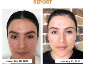 Thiccfitts™ Korea Highprime Soluble Collagen Film