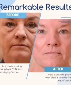 YoungAgain™ Bootox Anti-Aging Serum