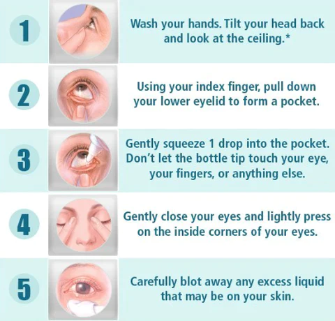 Znisnky™ Augentropfen mit natürlichen Extrakten für trockene Augen