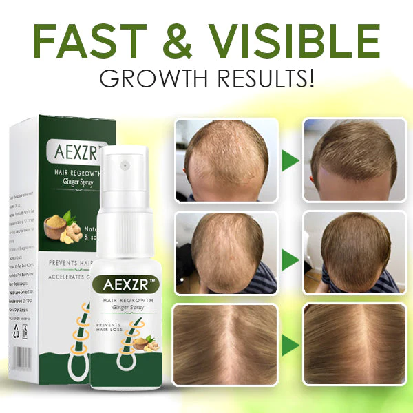 Zázvorový sprej pro obnovu růstu vlasů AEXZR™