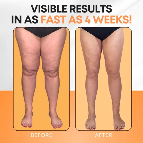 AEXZR™ Lymphdrainage-Gesundheitspflaster