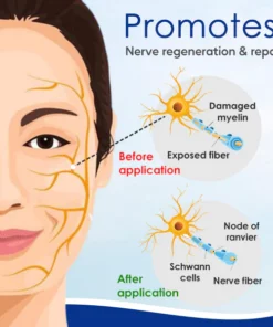 Alternative view of AEXZR™ Nerve Cure Patch
