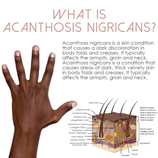 ATTDX Acanthosis Nigricans TherapyOil ਨੂੰ ਹਲਕਾ ਕਰਦਾ ਹੈ
