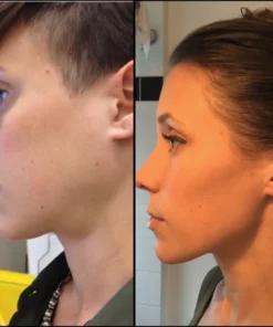 ATTDX LymphCare DetoxificationHerbal Patch