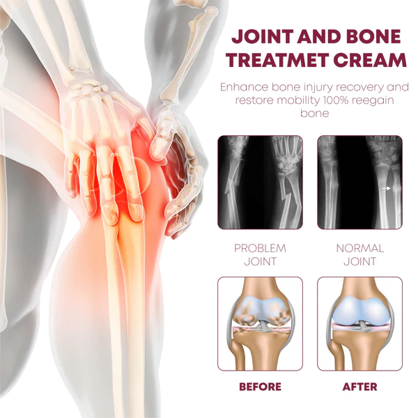 ATTDX ProRelief JointRecovery TherapyCream - Image 4