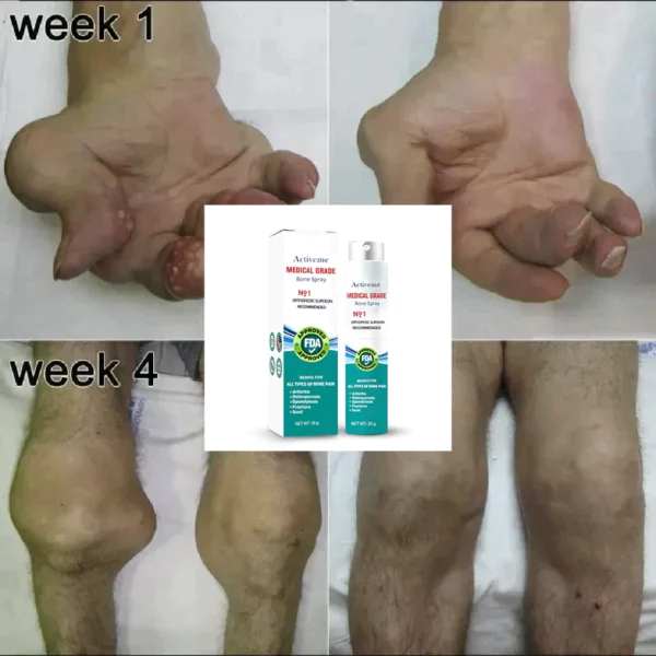 Activeme™ Gelenk- und Knochentherapie-Spray