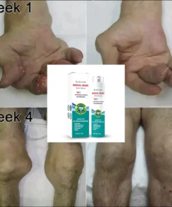 Activeme™ Joint & Bone Therapy Spray